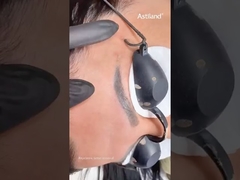 Nd Yag Laser для удаления татуировки бровей #ndyaglaser #tattooremovallaser #beautymachine #laserclinic