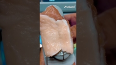 Демонстрация лифтинга HIFU #машина красоты #hifu #облегчение кожи #клиника красоты #светлая кожа #УЗИ